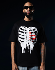 HEART BREACK CLUB - BONES OVERSIZE